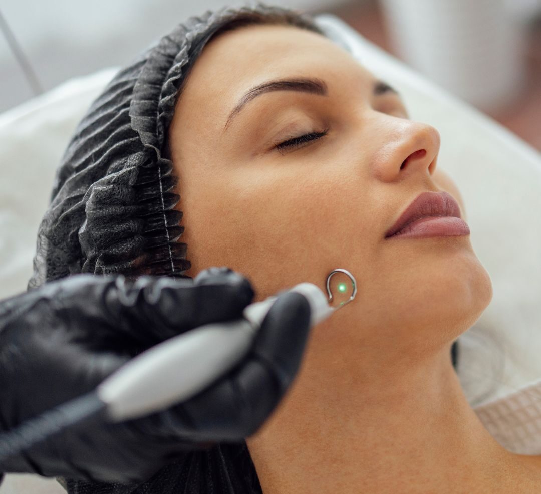 Cosmetic Mole & Skin Tag Removal clinic