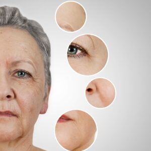 treatment for facial fine lines and wrinkles