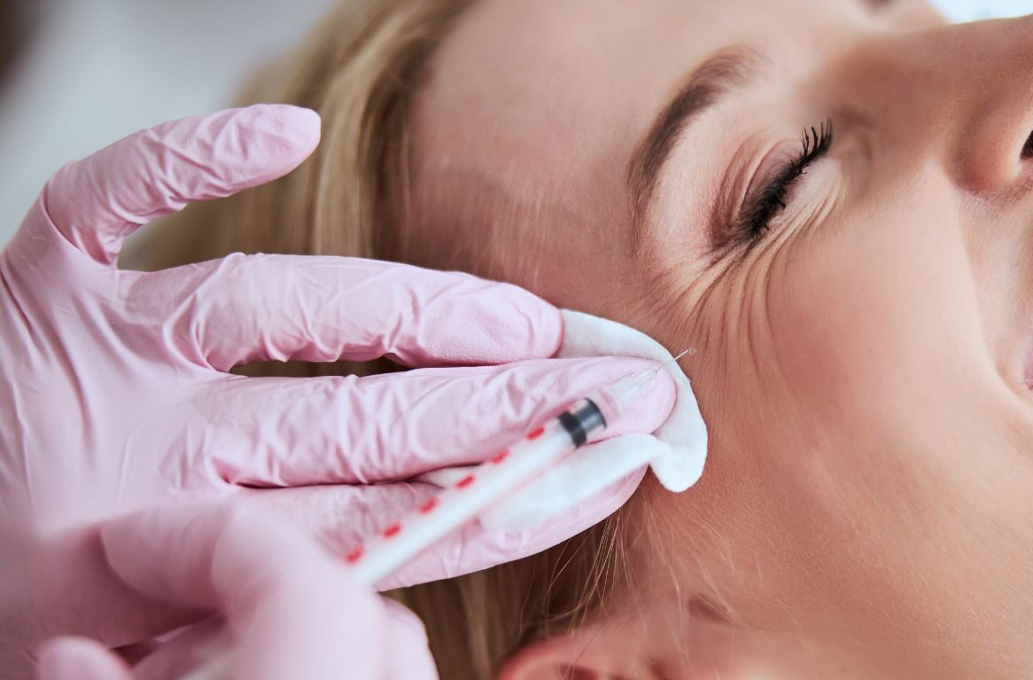 anti wrinkle injections for crows feet and other facial lines
