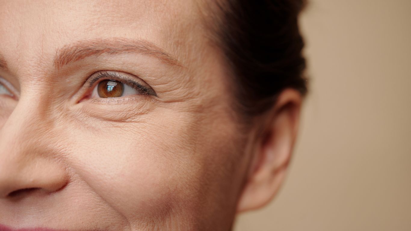 Laser for wrinkles and fine lines